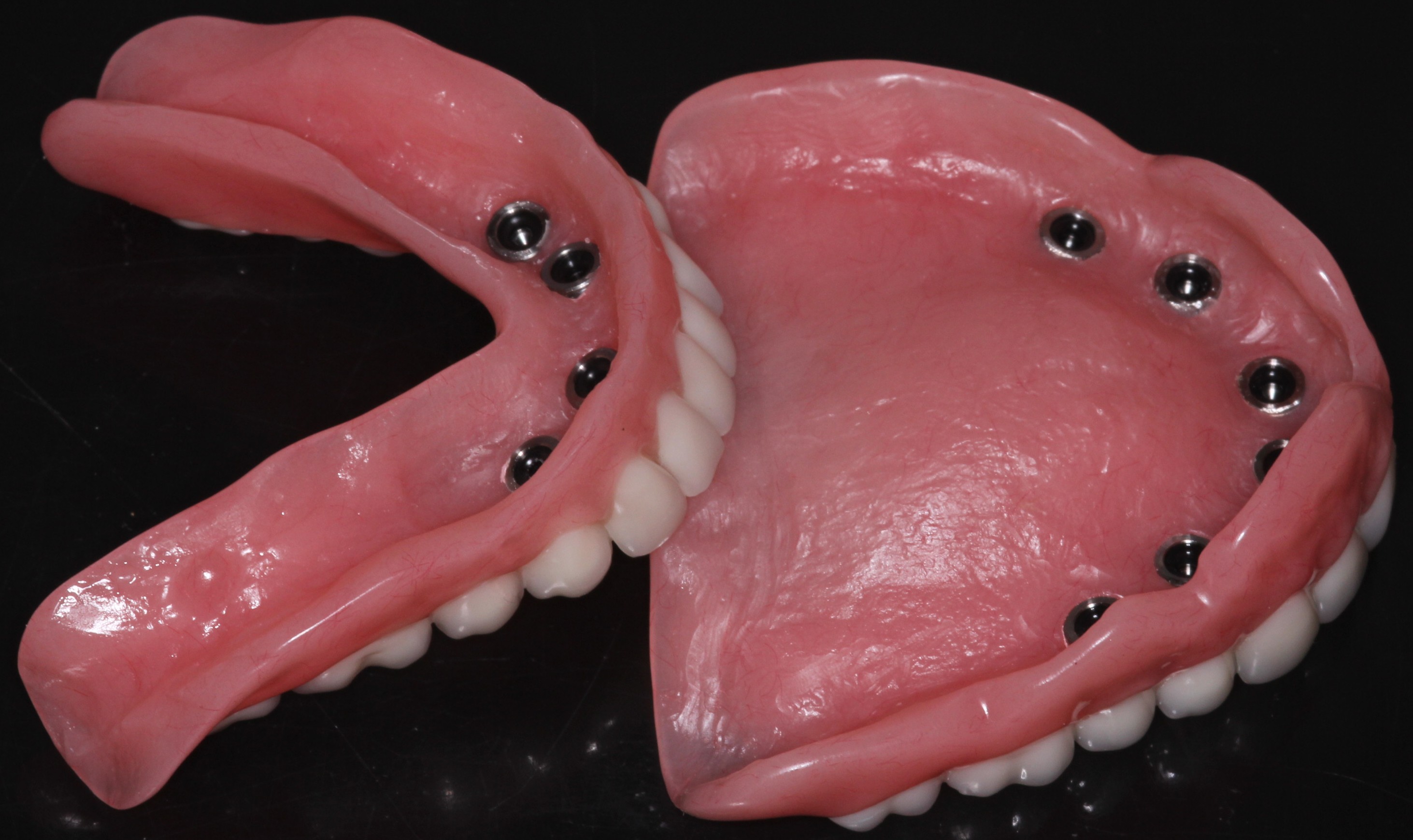 Artificial denture